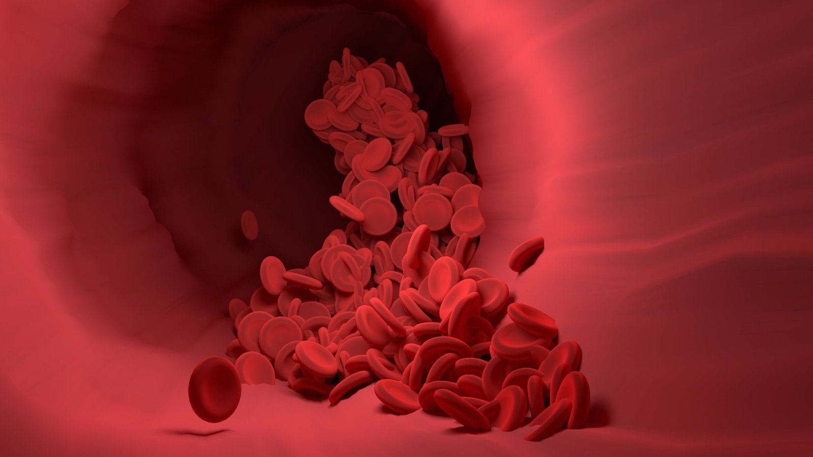 Hematología Pediátrica