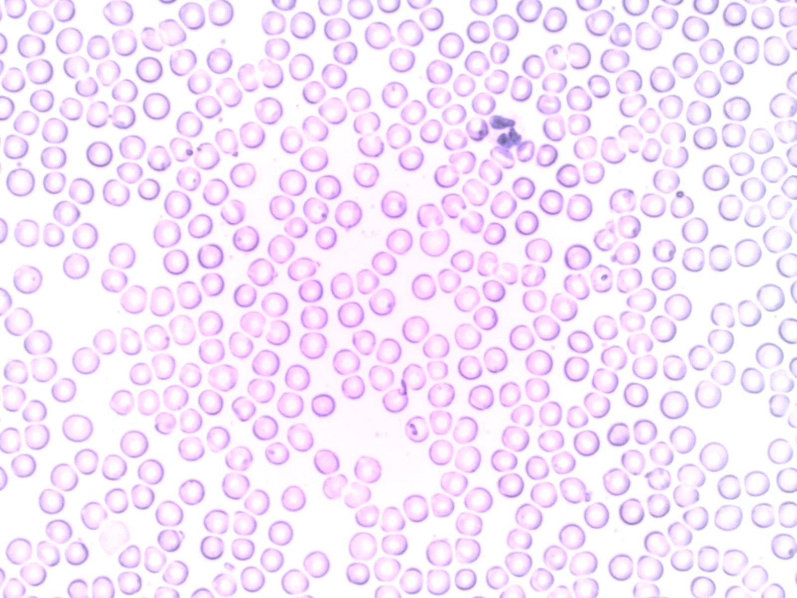 Hematologia adulto